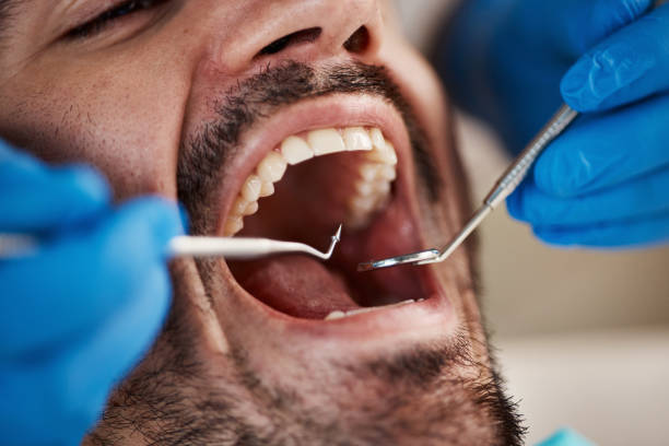 Best Emergency Broken Tooth Repair in Kiln, MS
