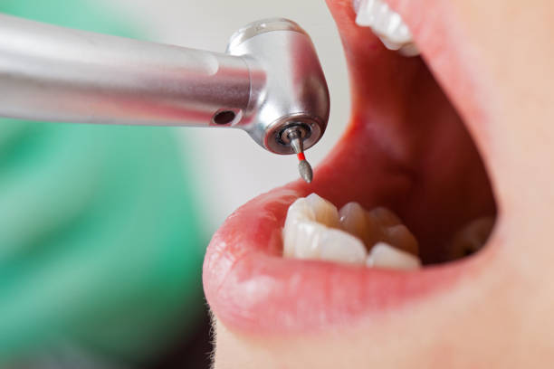 Best Emergency Root Canal Treatment in Kiln, MS